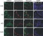 N-cadherin Antibody in Immunohistochemistry (IHC)