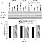 Phospho-EIF2S1 (Ser52) Antibody in Western Blot (WB)