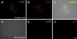 Connexin 26 Antibody in Immunocytochemistry (ICC/IF)