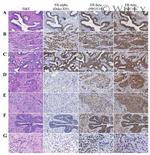 Estrogen Receptor beta Antibody in Immunohistochemistry (Paraffin) (IHC (P))