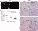 Claudin 5 Antibody in Immunohistochemistry (IHC)