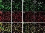 Connexin 30 Antibody in Immunohistochemistry (IHC)