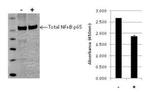 Human NFkB p65 (Total) InstantOne™ ELISA Kit