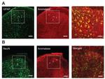 GFAP Antibody in Immunohistochemistry (IHC)