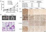 E-cadherin Antibody in Immunohistochemistry (IHC)