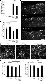PSD-95 Antibody in Immunohistochemistry (IHC)