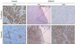 E-cadherin Antibody in Immunohistochemistry (IHC)