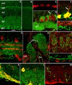 TRPV4 Antibody in Immunohistochemistry (IHC)