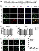 alpha Synuclein Antibody in Immunocytochemistry (ICC/IF)
