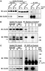 Xpress Antibody in Immunoprecipitation (IP)