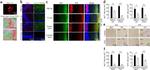 Tau Antibody in Immunohistochemistry (IHC)