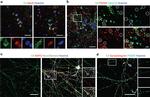 PSD-95 Antibody in Immunohistochemistry (IHC)