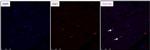 Ki-67 Antibody in Immunohistochemistry (IHC)