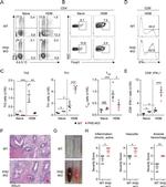 FOXP3 Antibody in Flow Cytometry (Flow)
