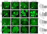 Estrogen Receptor beta Antibody in Immunohistochemistry (IHC)