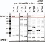 Dicer Antibody in Western Blot (WB)