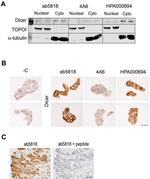 Dicer Antibody in Immunohistochemistry (IHC)