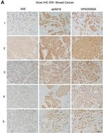 Dicer Antibody in Immunohistochemistry (IHC)