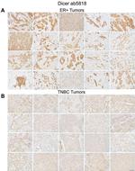 Dicer Antibody in Immunohistochemistry (IHC)