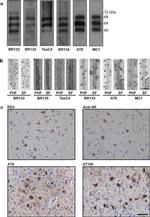 Tau Antibody in Western Blot (WB)