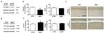 PSD-95 Antibody in Western Blot (WB)