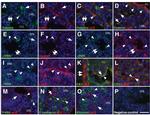 E-cadherin Antibody in Immunohistochemistry (Frozen) (IHC (F))