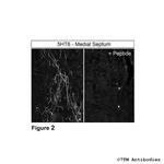5-HT6 (5-HT Receptor 6) Antibody in Immunohistochemistry (Paraffin) (IHC (P))