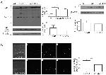 beta Amyloid Antibody in Western Blot (WB)