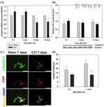 Claudin 5 Antibody in Western Blot (WB)