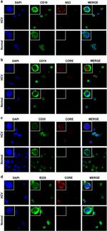 Hepatitis C Virus Core Antigen Antibody in Immunocytochemistry (ICC/IF)