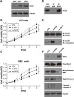 Ku70 Antibody in Western Blot, Immunoprecipitation (WB, IP)