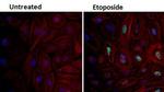 Phospho-p53 (Ser15) Antibody in Immunocytochemistry (ICC/IF)