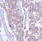 delta Catenin Monoclonal Antibody (SP63)