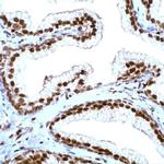 p27 Kip1 Polyclonal Antibody