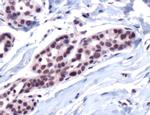 CBP Antibody in Immunohistochemistry (IHC)