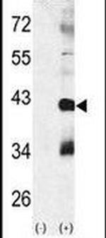 p38 MAPK beta Antibody in Western Blot (WB)