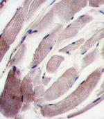 p38 MAPK gamma Antibody in Immunohistochemistry (IHC)