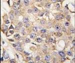 ERK1 Antibody in Immunohistochemistry (IHC)