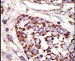 ERK1 Antibody in Immunohistochemistry (IHC)