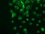 p53 Antibody in Immunocytochemistry (ICC/IF)