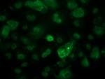 p53 Antibody in Immunocytochemistry (ICC/IF)