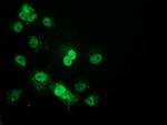 p53 Antibody in Immunocytochemistry (ICC/IF)