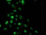 p53 Antibody in Immunocytochemistry (ICC/IF)