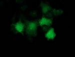 p53 Antibody in Immunocytochemistry (ICC/IF)
