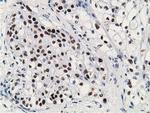 p53 Antibody in Immunohistochemistry (Paraffin) (IHC (P))