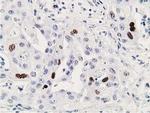 p53 Antibody in Immunohistochemistry (Paraffin) (IHC (P))