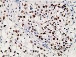 p53 Antibody in Immunohistochemistry (Paraffin) (IHC (P))