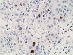 p53 Antibody in Immunohistochemistry (Paraffin) (IHC (P))
