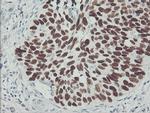 p53 Antibody in Immunohistochemistry (Paraffin) (IHC (P))
