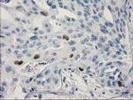p53 Antibody in Immunohistochemistry (Paraffin) (IHC (P))